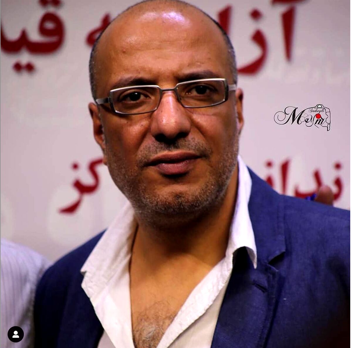 تغییر چهره عجیب امیر جعفری در سریال جیران جنجالی شد