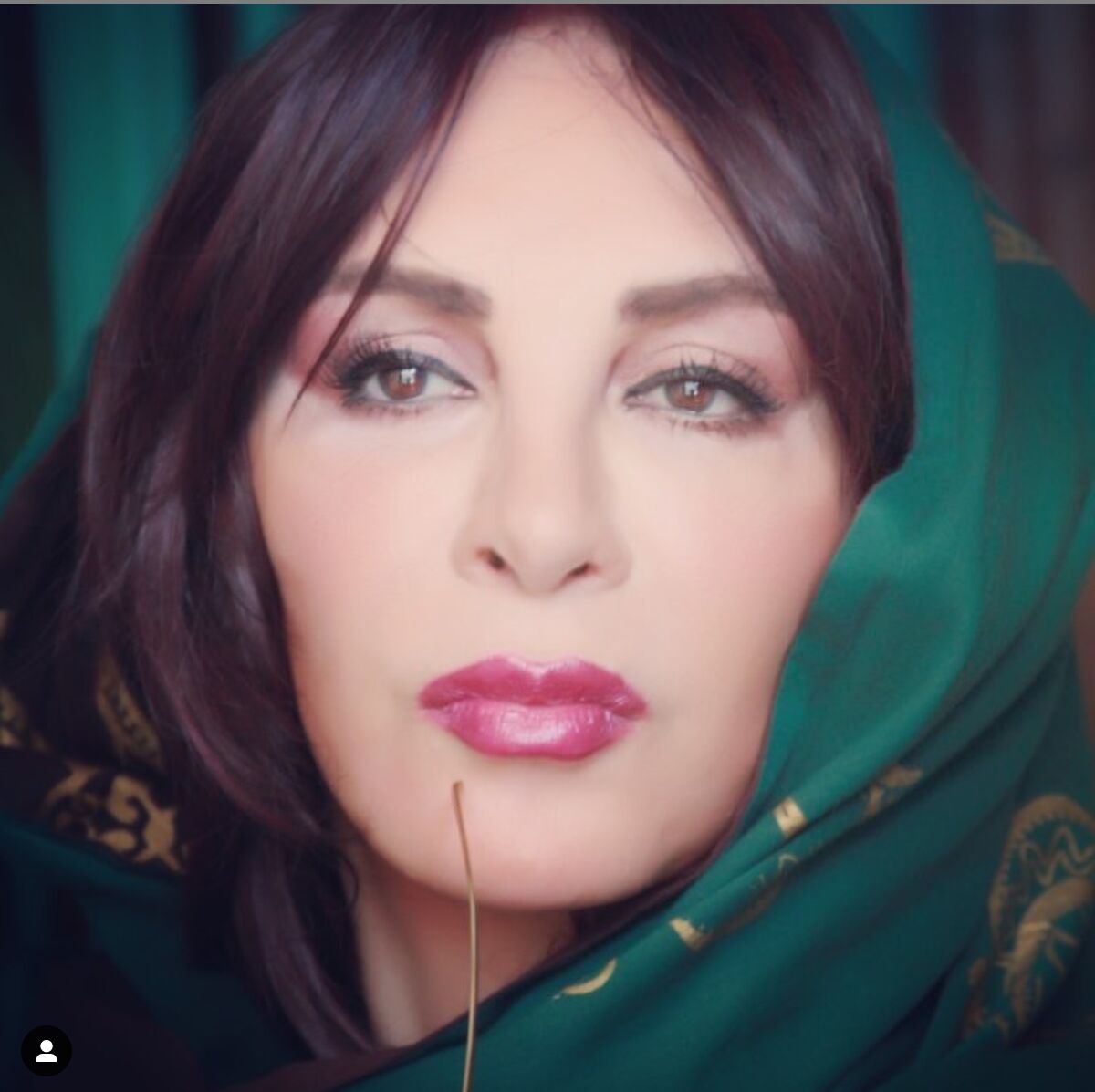  جدیدترین عکس افسانه بایگان بعد از عمل زیبایی| ژست هنجارشکن افسانه بایگان در این سن!