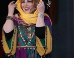 سلفی خجالت آور بهنوش بختیاری با صورت تزریقی ورم کرده!