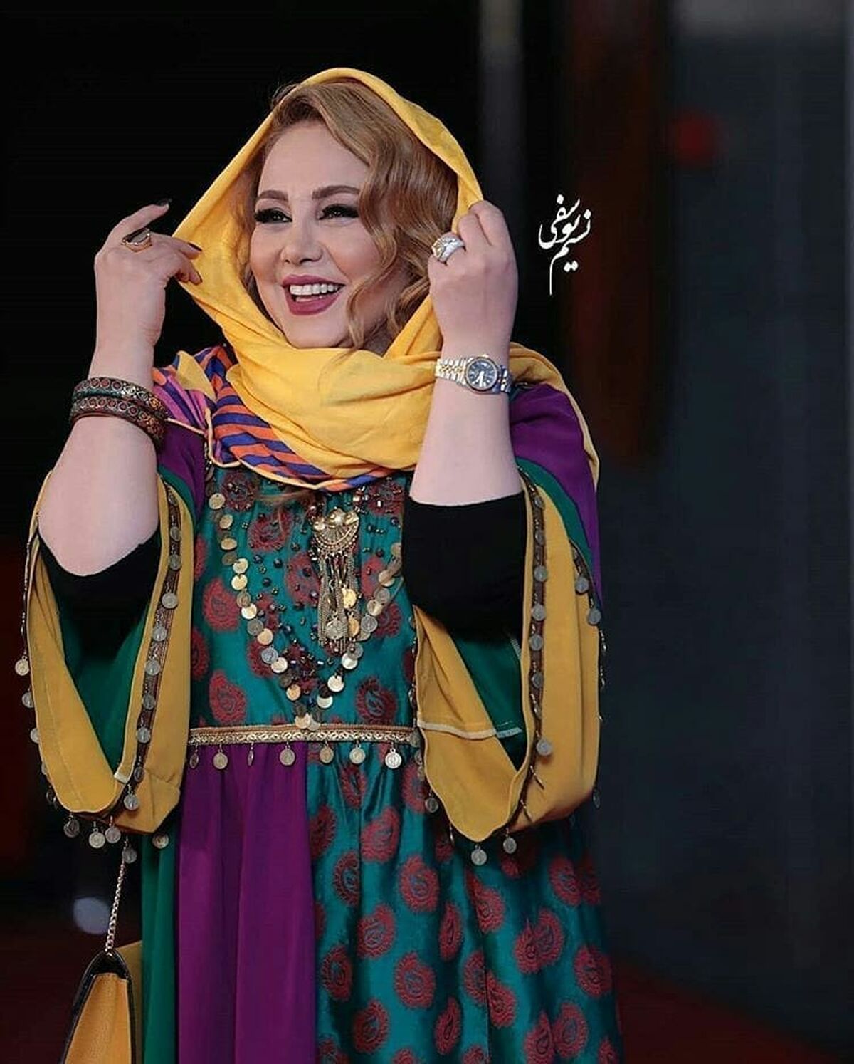 سلفی خجالت آور بهنوش بختیاری با صورت تزریقی ورم کرده!