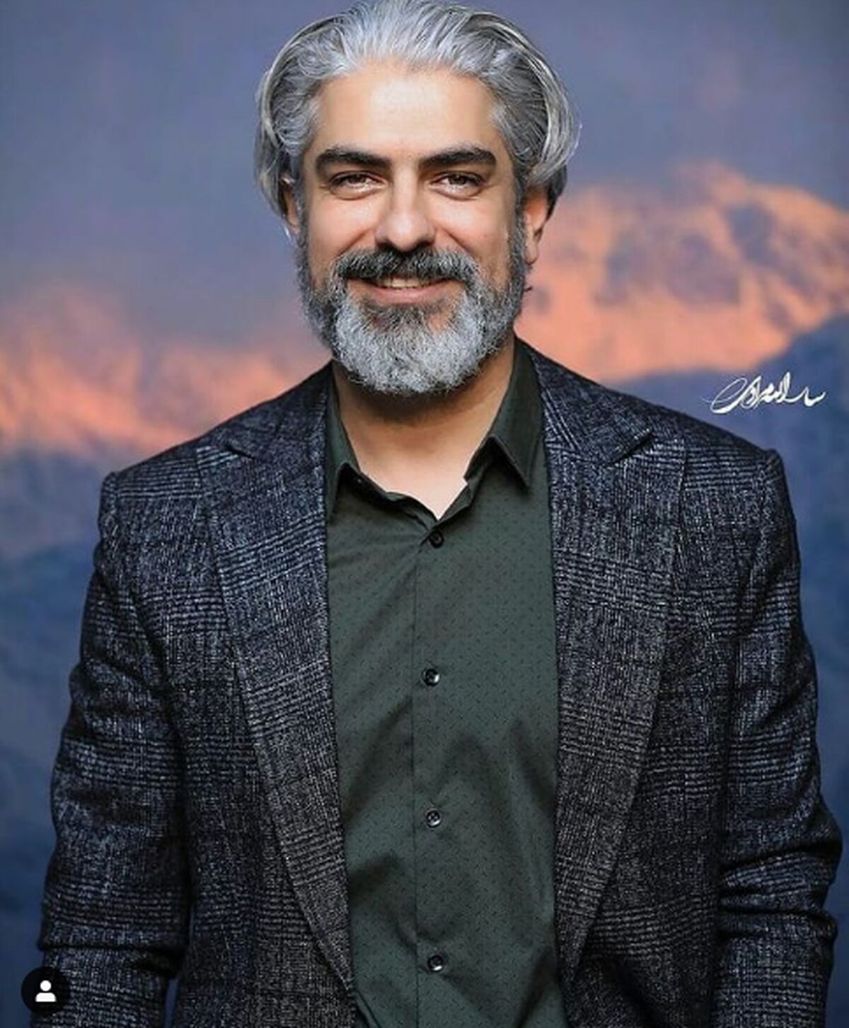 تغییر چهره مهدی پاکدل همه را شوکه کرد!