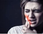 دندان درد دارید؟ | این مسکن را هرگز مصرف نکنید