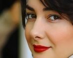 صورت هانیه توسلی نابود شد| عکسی که باور نمی کنید