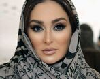 اسیدپاشی به صورت الهام حمیدی! | الهام حمیدی زیبایی چهره اش را از دست داد