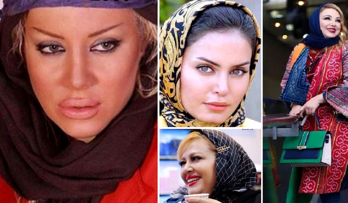 زیبایی پلاستیکی  این چند بازیگر زن ایرانی را ببینید! | جراحی پلاستیکو تا آخر راه رفتن!