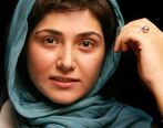 تغییر چهره وحشتناک باران کوثری/ عکس دیده نشده