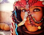 بیماری عجیب شهرزاد کمال زاده بازیگر گاندو۲