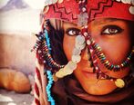 بیماری عجیب شهرزاد کمال زاده بازیگر گاندو۲