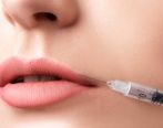 آشنایی با تزریق ژل لب