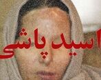 زن جوان قربانی اسیدپاشی شد | اسیدپاشی هولناک مرد ناشناس به زن جوان