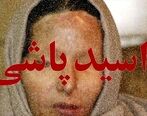 اسیدپاشی به صورت شوهر فقط بخاطر یک عکس!/ در شمال تهران اتفاق افتاد