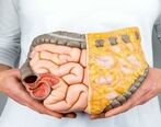معده درد با این میوه فوری درمان می شود