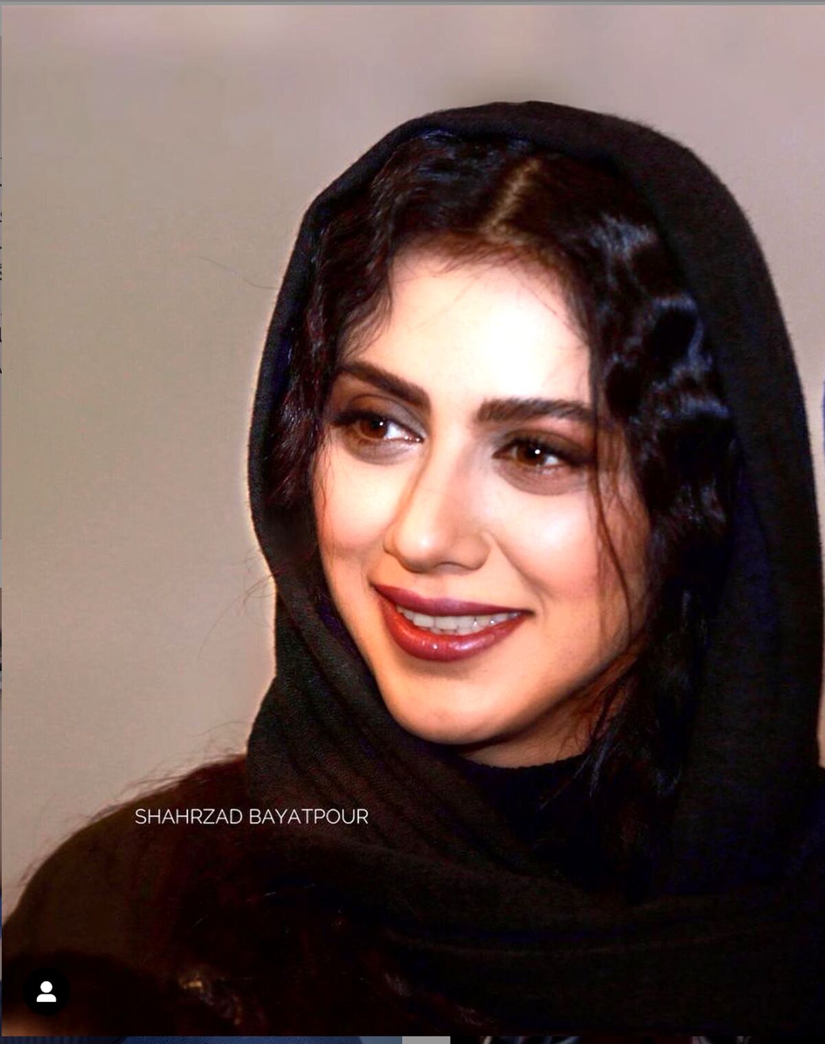 حال بد مونا فرجاد بر اثر کرونا