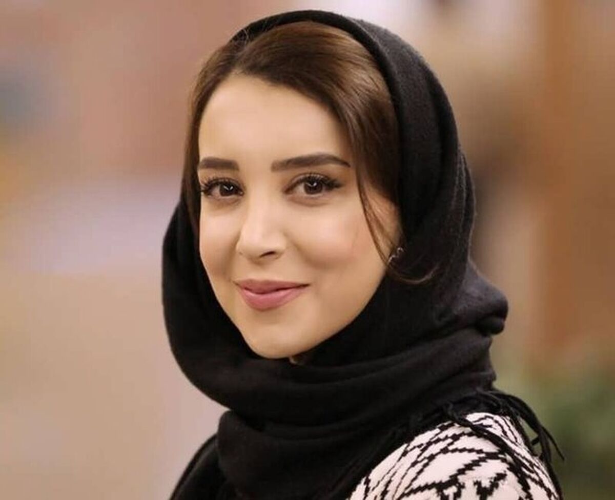 کج شدن فک بازیگر مشهور