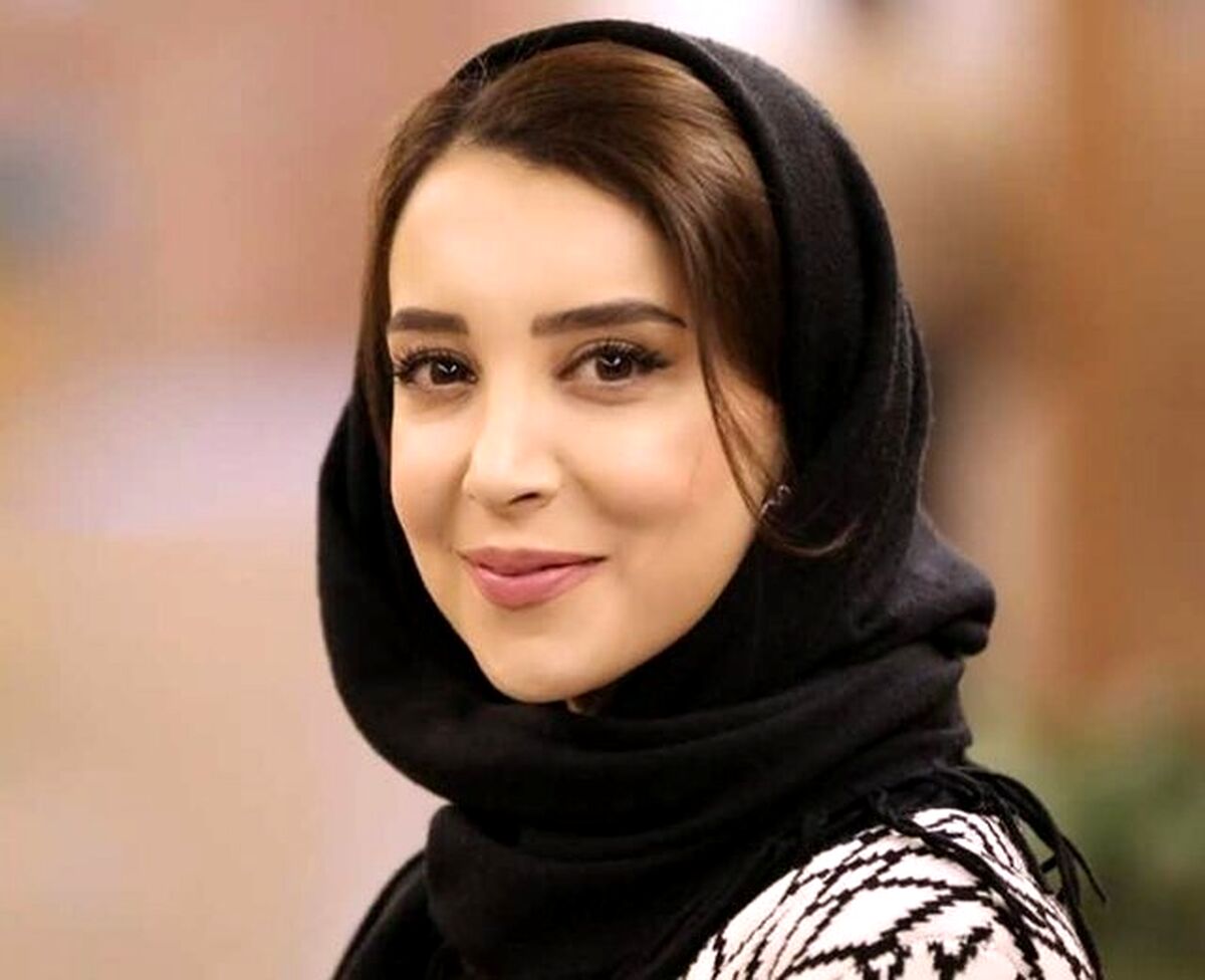 کج شدن فک بازیگر مشهور