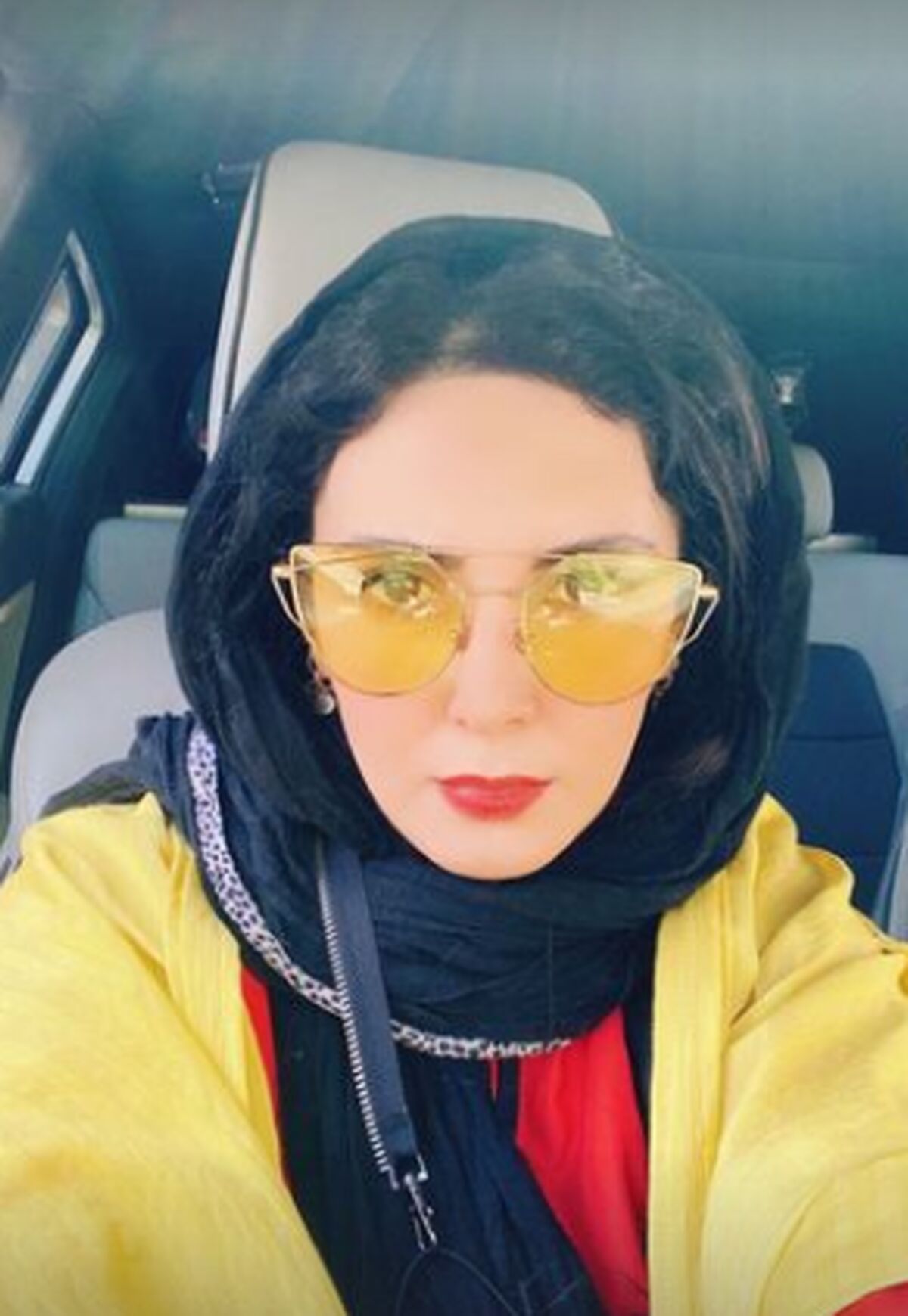 تغییر فاحش صورت لیلا بلوکات 