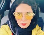 تغییر فاحش صورت لیلا بلوکات 