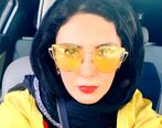 تغییر فاحش صورت لیلا بلوکات 
