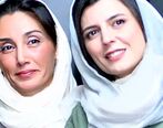 این بازیگران زن عمل زیبایی نکرده اند