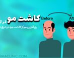 بهترین کلینیک کاشت مو و ابرو در تهران