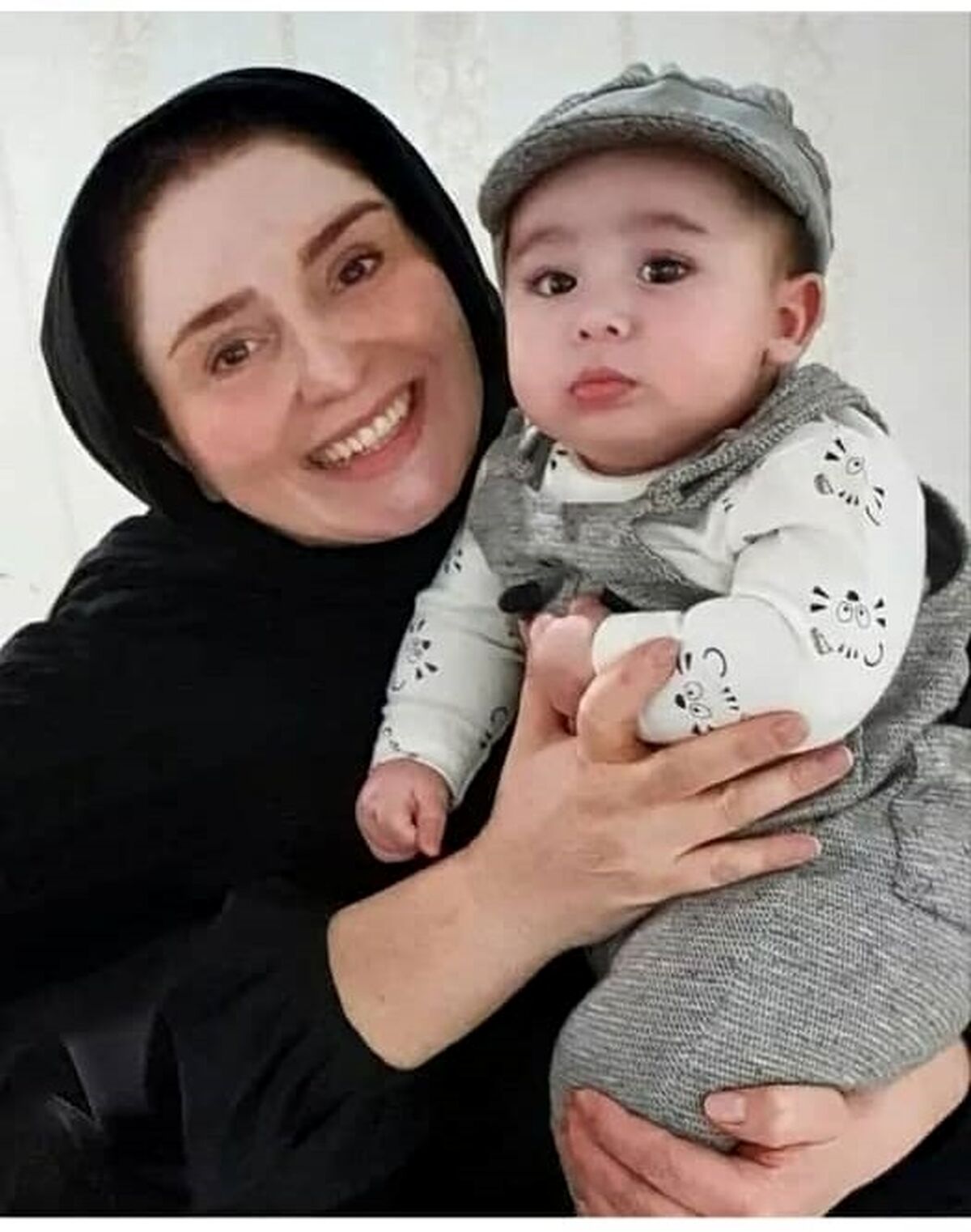 عکس قبل و بعد عمل زیبایی ژاله صامتی را مقایسه کنید! 