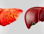 یک روش ساده گیاهی برای درمان 