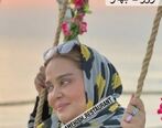  فرم چشم بهاره رهنما بعد عمل بهم ریخت!