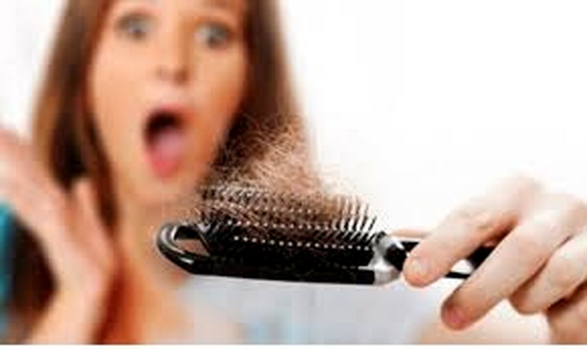 با این روش خانگی از شر ریزش مو خلاص شوید/ یک راه حل ساده برای رفع ریزش مو