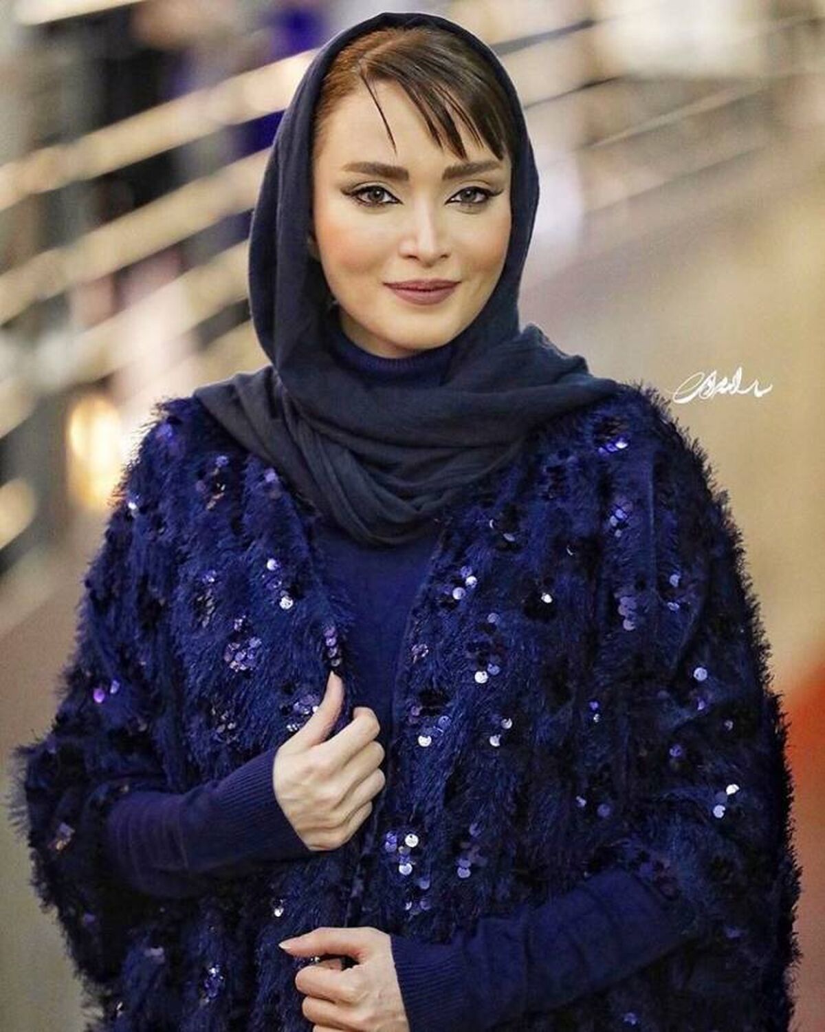 تغییر شوک آور چهره بهنوش طباطبایی بعد از 20 سال | بهنوش طباطبایی با چند تا عمل جراحی و تزریق از خودش بازیگر بیرون آورد؟