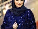 تغییر شوک آور چهره بهنوش طباطبایی بعد از 20 سال | بهنوش طباطبایی با چند تا عمل جراحی و تزریق از خودش بازیگر بیرون آورد؟