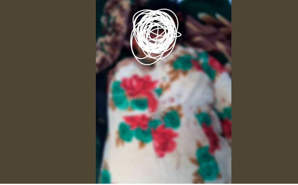 تکه پاره شدن این زن توسط طالبان+ عکس دلخراش