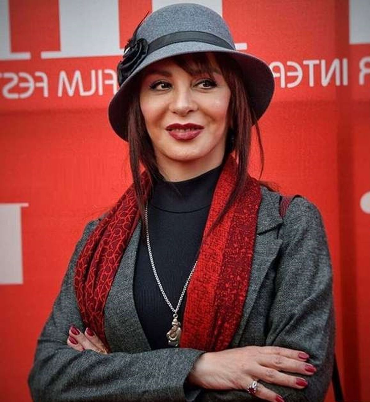  افسانه بایگان با صورت پروتزی در 60 سالگی کنار مرد جوان قرار گرفت