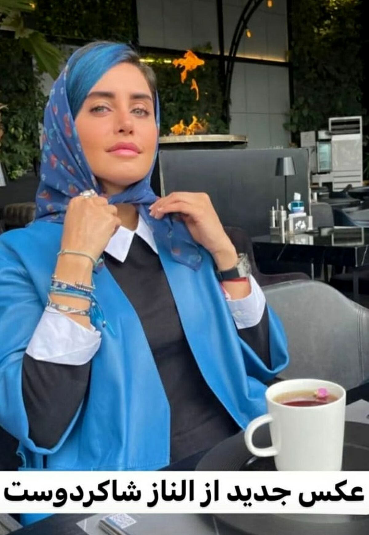 حادثه وحشتناک برای الناز شاکردوست | بینی الناز شاکردوست دفرمه شد! | چه اتفاقی برای الناز شاکردوست افتاده است؟