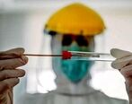 بهترین زمان برای انجام تست pcr چه موقع است ؟ + جزئیات 