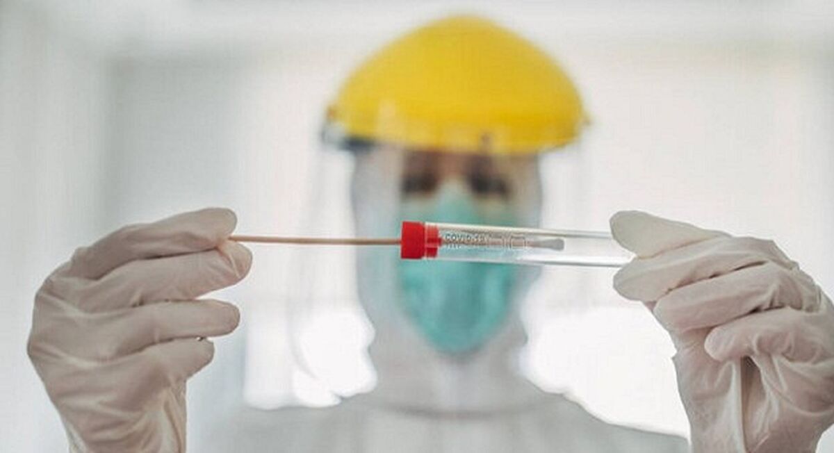 بهترین زمان برای انجام تست pcr چه موقع است ؟ + جزئیات 