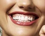 چگونه از لثه‌هایمان به درستی مراقبت کنیم؟