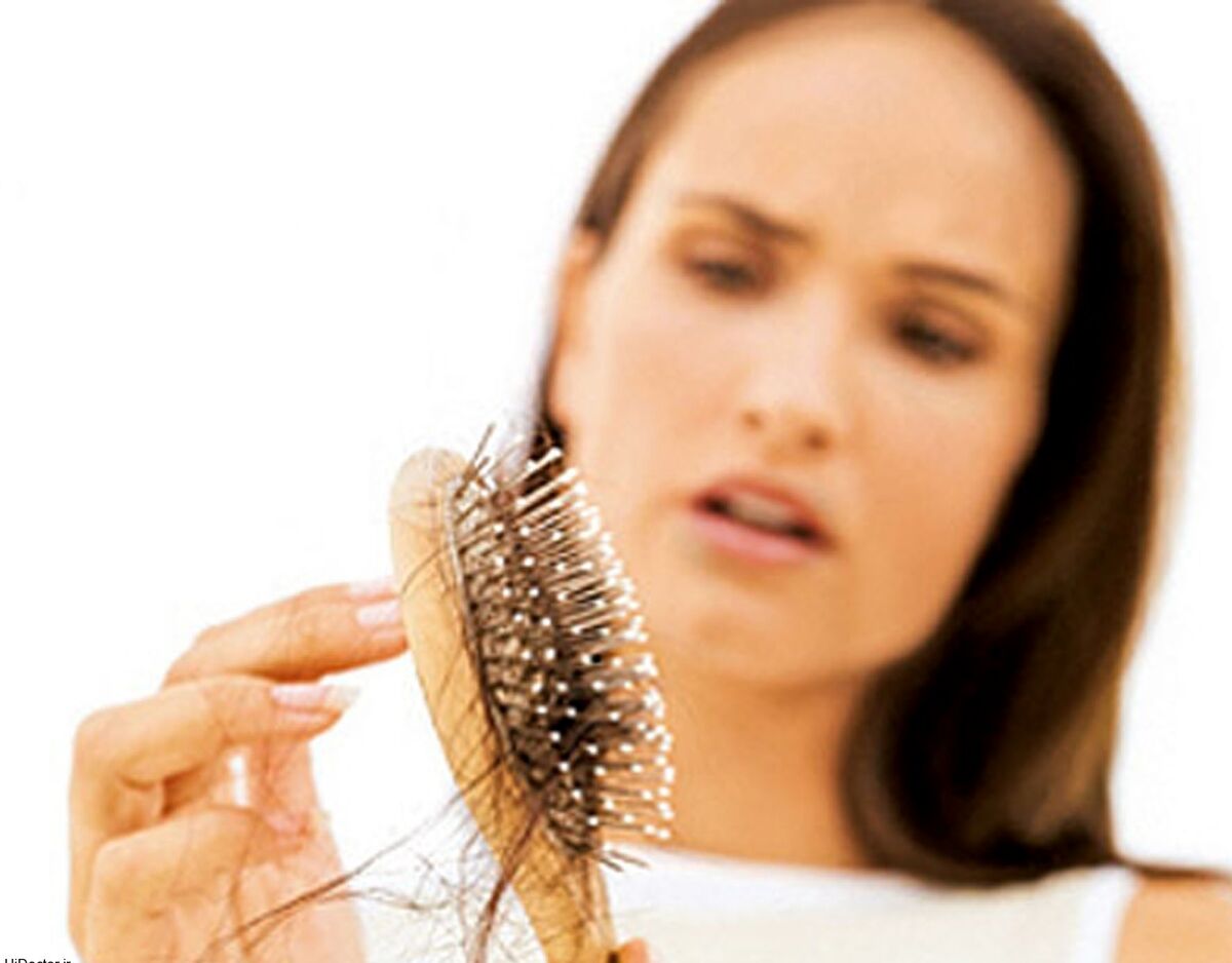 دلیل اصلی ریزش مو چیست؟